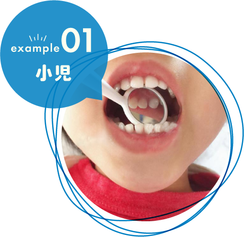 小児