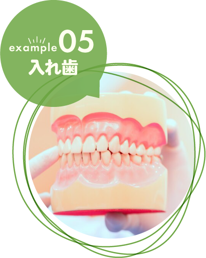 入れ歯