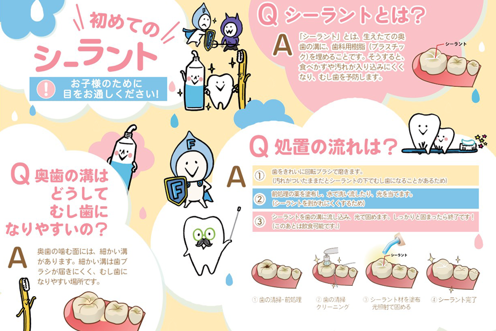 資料(シーラント)